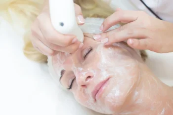 Lifting facial con radiofrecuencia