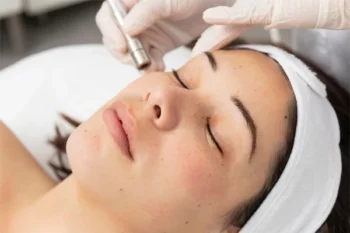 Mesoterapia Dermapen cóctel